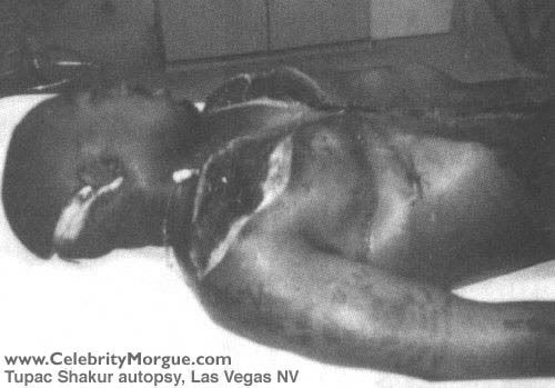 tupac dead body pics. hair which Autopsytupac shakur